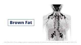 Drug Activates Brown Fat in Early Trials