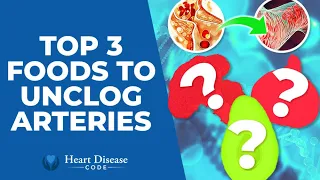Top 3 Foods To Unclog Arteries