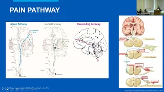 Lecture Series - Rushna P Ali MD (05-15-2023)