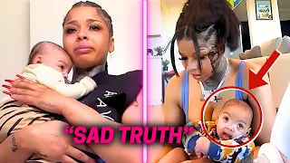 What Really Happened To Chrisean Rock's Son | Blindness & Disability?