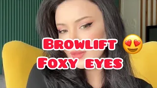 Броулифт и лисьи глазки без хирургии😍🛑Browlift/foxy eyes