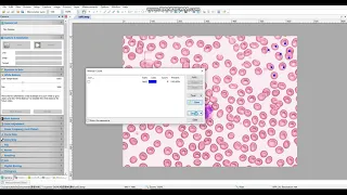 Microscope camera software introduction: Manual Cell Counting