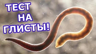 ТЕСТ НА НАЛИЧИЕ ГЛИСТОВ! ПРОВЕРЬСЯ!