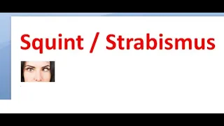 Ophthalmology 353 Strabismus Squint Why does it happen Basic concepts Eye Movement Define