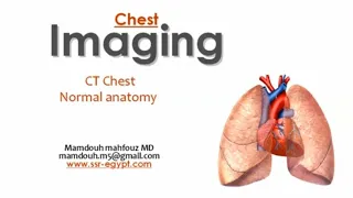 CT anatomy of the chest (DRE) Prof. Mamdouh Mahfouz