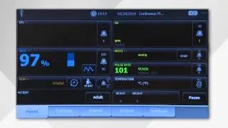 Welch Allyn Connex Vital Signs Monitor User Guide