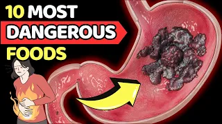 STOP IT! Top 10 Most Dangerous Foods That People Keep Eating EVERY DAY.| Vitality Solutions