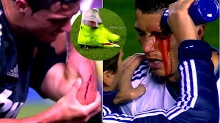 Cristiano Ronaldo ► Top 5 Horror Injuries ever in his Career | HD