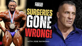 Watch this before getting gyno surgery | #30 IFBBAMA Podcast with Jose Raymond!