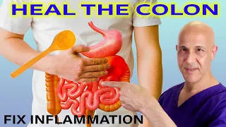 1/5 of a Teaspoon…Repairs Inflammation & Heals the Colon!  Dr. Mandell