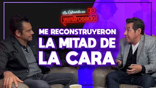 Tenía FRACTURA EXPUESTA en la CARA | Eugenio Derbez | La entrevista con Yordi Rosado