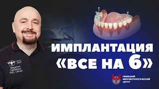 "ВСЕ НА 6" или ALL ON 6 - мнение эксперта с 27-летним опытом в имплантации