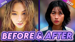 HoYeon Jung | Before & After | Squid Game Star Plastic Surgery Transformation & More