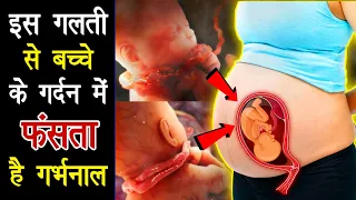 आपके इस गलती से शिशु के गर्दन से लिपट जाता है गर्भनाल | Nuchal cord kya hai Pregnancy tips in Hindi