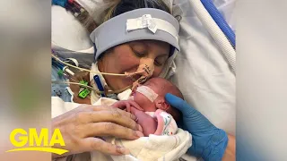 Mom delivers while sedated due to COVID, meets baby 1 month later l GMA