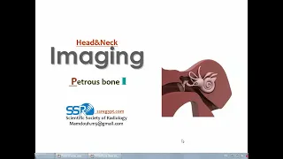 Imaging of Petrous bones (I) (DRE) Prof. Mamdouh Mahfouz