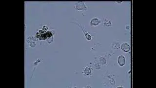 Semen (sperm) under the microscope. [Сперма под микроскопом]