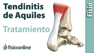 TENDINITIS del TENDÓN de AQUILES