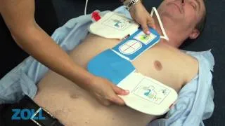 Introducing the ZOLL AED Plus