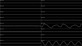 Foregone Destruction — Oscilloscope Visualization