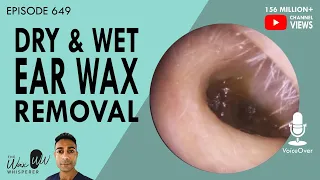 649  - Dry & Wet Ear Wax Removal