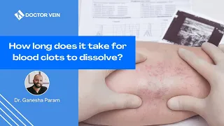 How long does it take for blood clots to dissolve?