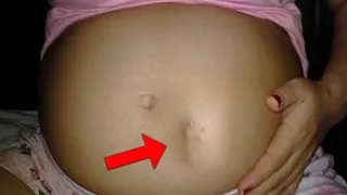 The girl gave birth to a daughter. After a while, she felt that something was moving in her stomach!