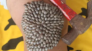 We Help Cleaning Million Big Ticks on Knee Man With Hammer That Work 100% #1099