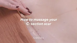 How to Massage your C Section Scar | with Clare Bourne Physio