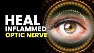 Heal Inflamed Optic Nerve | Get Rid From Pain In Eye Blurry Vision & Weak Eyesight | Binaural Beats