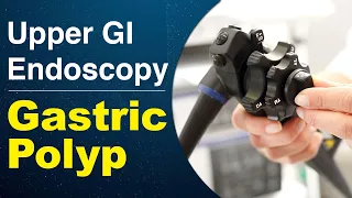 Upper GI Endoscopy - Gastric Polyp