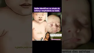 Sinais de esforço respiratório no bebê