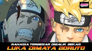 RAHASIA TERBESAR BEKAS LUKA DIMATA BORUTO