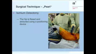 Technique of Bernese periacetabular osteotomy by T. Ecker (CH)