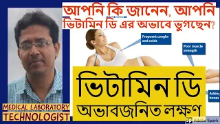 Vitamin D Deficiency Symptoms: ভিটামিন ডি: অভাবজনিত লক্ষণ (Vitamin D abhavejanito laxkhan)