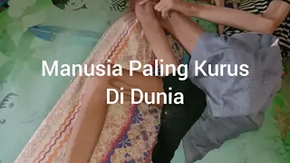 Manusia Paling Kurus di Dunia