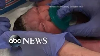 First Zika-Affected Baby Born in the US