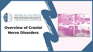 Overview of Cranial Nerve Disorders