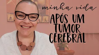 TUMOR CEREBRAL | Como é minha vida Após um Tumor Cerebral? Dani Louzada - Youtuber