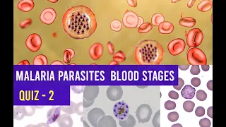 Malaria Parasites Blood stages Identification Training  - Quiz 2