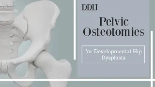 Pelvic Osteotomies for Developmental Hip Dysplasia - DDH