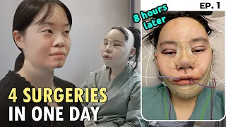 [SUB] "I GOT A FULL FACE PLASTIC SURGERY IN KOREA" VLOG | FACIAL CONTOURING, RHINOPLASTY & RECOVERY