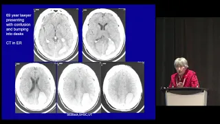 Dr. Sandra Black: Connecting the heart, brain and mind