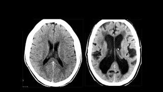 Dr Mamdouh Mahfouz Brain imaging Normal anatomy and CVS