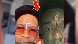 Lil Uzi and Tory Lanez Implants Diamond Into thier Head complete video show the complete process