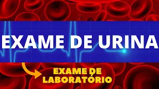 EXAME DE URINA - COMO FAZER, PARA QUE SERVE, COMO INTERPRETAR - TUDO SOBRE EXAME DE URINA