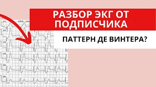 Паттерн де Винтера. Разбор ЭКГ от подписчика. Острый коронарный синдром без подъема сегмента ST.