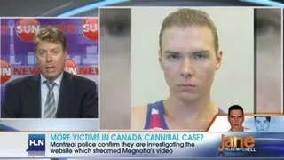 Vancouver body parts linked to Magnotta