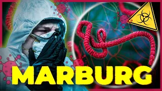 Vírus Marburg: O PRIMO LETAL DO EBOLA QUE ASSUSTOU O MUNDO