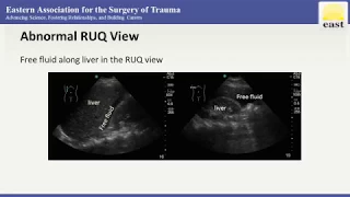 EAST Master Class Webinar - Ultrasound in Trauma and ICU Care